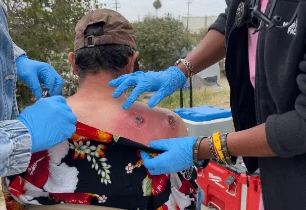 Clinic on Wheels: In L.A., Street Medicine Take Health Care to the Unhoused
